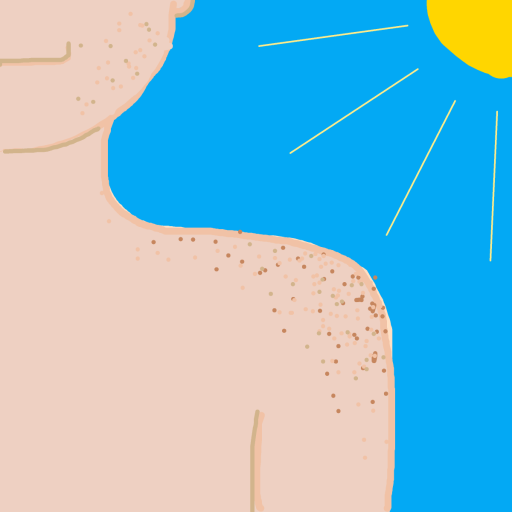 Freckles drawing by firecracker