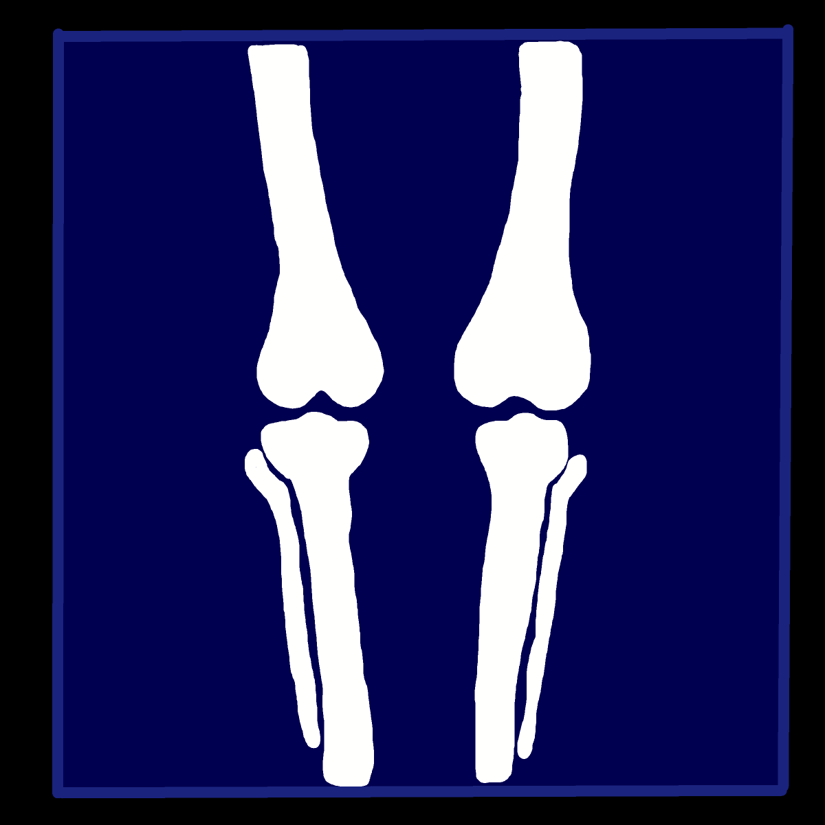 Bone drawing by marimou