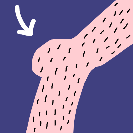 Kneecap drawing by jashezilla