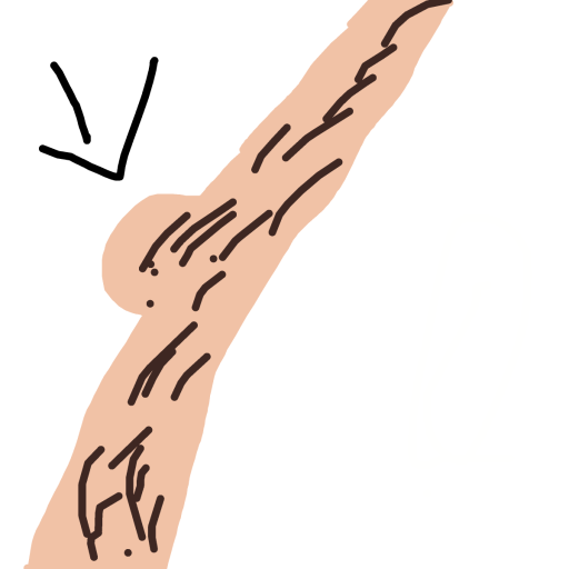 Knee drawing by treehugger0707