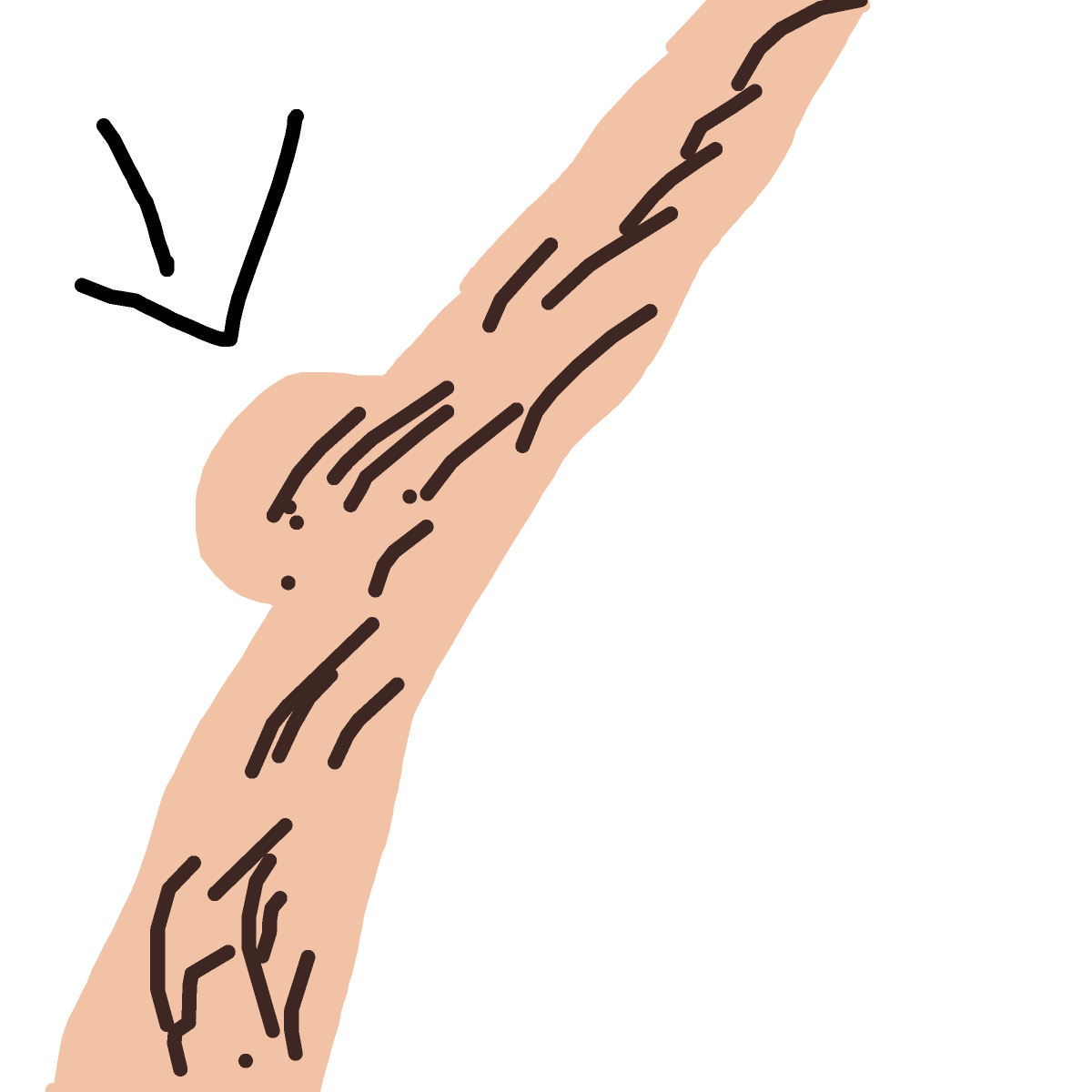 Knee drawing by treehugger0707
